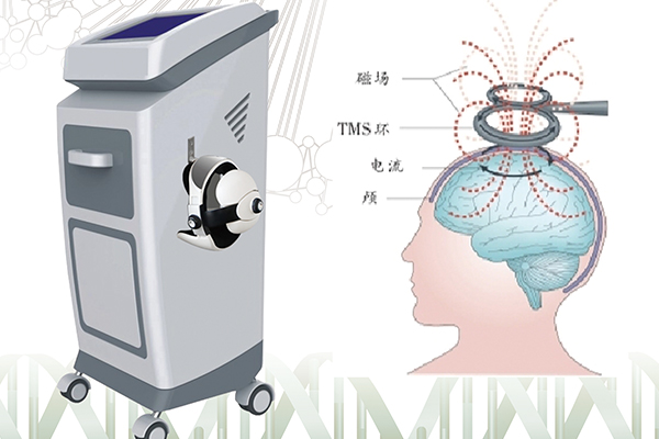 成都供應(yīng)經(jīng)顱磁刺激治療儀廠家