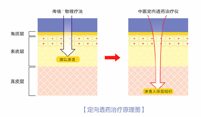 療法對(duì)比1.png